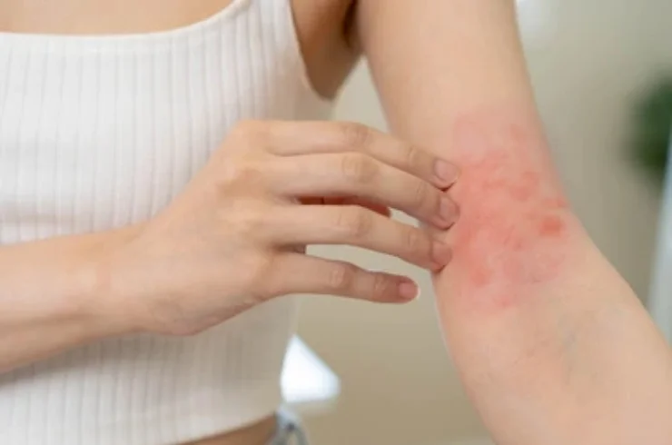 Allergy & Skin Care